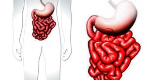 enfermedad de crohn