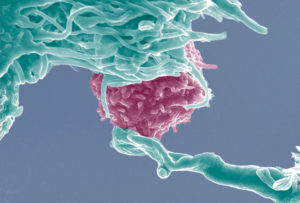 la-proteina-nfat5-posible-protectora-de-alteraciones-inmunologicas_image_380